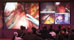 Why Gastric cancer experts are opting for remote education